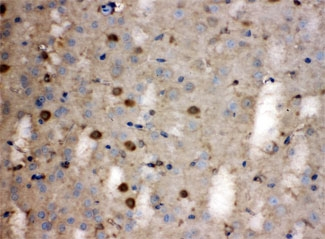 LDHB / Lactate Dehydrogenase B Antibody - IHC testing of FFPE human brain with LDHB antibody at 1ug/ml. HIER: steam section in pH6 citrate buffer for 20 min.