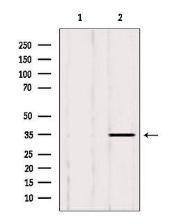 LDHB / Lactate Dehydrogenase B Antibody - Western blot analysis of extracts of 293 cells using LDHB antibody. Lane 1 was treated with the blocking peptide.