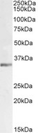LDHC / Lactate Dehydrogenase C Antibody - LDHC / Lactate Dehydrogenase C antibody (1µg/ml) staining of Mouse Testes lysate (35µg protein in RIPA buffer). Primary incubation was 1 hour. Detected by chemiluminescence.