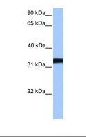 LDHC / Lactate Dehydrogenase C Antibody - NTERA2 cell lysate. Antibody concentration: 1.0 ug/ml. Gel concentration: 12%.  This image was taken for the unconjugated form of this product. Other forms have not been tested.