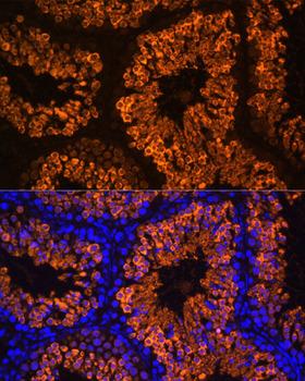 LDHC / Lactate Dehydrogenase C Antibody - Immunofluorescence analysis of Mouse testis using LDHC Polyclonal Antibody at dilution of 1:100 (40x lens).Blue: DAPI for nuclear staining.