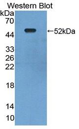 LDHD / Lactate Dehydrogenase D Antibody - Western blot of LDHD / Lactate Dehydrogenase D antibody.