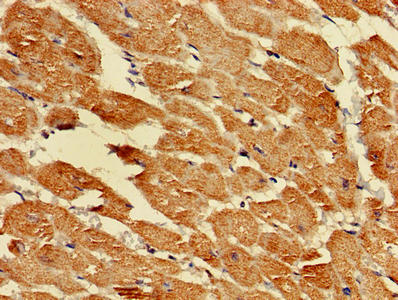 LDHD / Lactate Dehydrogenase D Antibody - Immunohistochemistry of paraffin-embedded human heart tissue using LDHD Antibody at dilution of 1:100