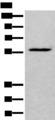 LDHD / Lactate Dehydrogenase D Antibody - Western blot analysis of HEPG2 cell lysate  using LDHD Polyclonal Antibody at dilution of 1:400