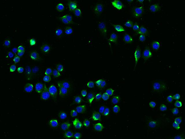 LDLR / LDL Receptor Antibody - Immunofluorescence staining of mLDLR in RAW264.7 cells. Cells were fixed with 4% PFA, blocked with 10% serum, and incubated with rabbit anti-mouse mLDLR monoclonal antibody (dilution ratio 1:60) at 4°C overnight. Then cells were stained with the Alexa Fluor 488-conjugated Goat Anti-rabbit IgG secondary antibody (green) and counterstained with DAPI (blue). Positive staining was localized to Cytoplasm .