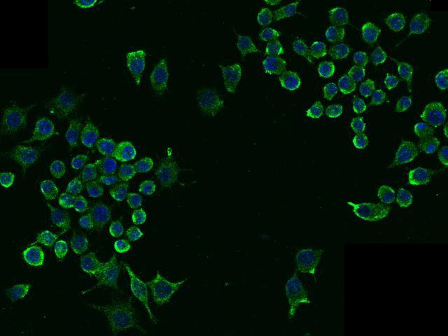 LDLR / LDL Receptor Antibody - Immunofluorescence staining of mLDLR in RAW264.7 cells. Cells were fixed with 4% PFA, blocked with 10% serum, and incubated with rabbit anti-mouse mLDLR monoclonal antibody (dilution ratio 1:60) at 4°C overnight. Then cells were stained with the Alexa Fluor 488-conjugated Goat Anti-rabbit IgG secondary antibody (green) and counterstained with DAPI (blue). Positive staining was localized to Cytoplasm .