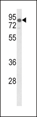 LDLR / LDL Receptor Antibody - Western blot of LDLR Antibody in mouse lung tissue lysates (35 ug/lane). LDLR (arrow) was detected using the purified antibody.