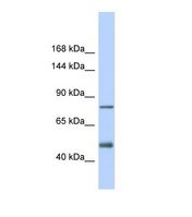 LDLR / LDL Receptor Antibody - Western blot of Human Fetal Heart. LDLR antibody dilution 1.0 ug/ml.  This image was taken for the unconjugated form of this product. Other forms have not been tested.