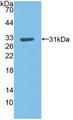 LDLR / LDL Receptor Antibody - Western Blot; Sample: Recombinant LDLR, Human.