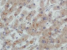 LDLR / LDL Receptor Antibody - Immunohistochemistry: LDL Receptor Antibody (C7) - Analysis of LDL Receptor on human liver.  This image was taken for the unconjugated form of this product. Other forms have not been tested.