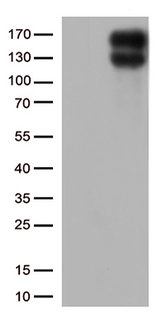 LDLR / LDL Receptor Antibody - HEK293T cells were transfected with the pCMV6-ENTRY control. (Left lane) or pCMV6-ENTRY LDLR. (Right lane) cDNA for 48 hrs and lysed. Equivalent amounts of cell lysates. (5 ug per lane) were separated by SDS-PAGE and immunoblotted with anti-LDLR. (1:2000)