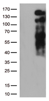 LDLR / LDL Receptor Antibody - HEK293T cells were transfected with the pCMV6-ENTRY control. (Left lane) or pCMV6-ENTRY LDLR. (Right lane) cDNA for 48 hrs and lysed
