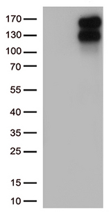 LDLR / LDL Receptor Antibody - HEK293T cells were transfected with the pCMV6-ENTRY control. (Left lane) or pCMV6-ENTRY LDLR. (Right lane) cDNA for 48 hrs and lysed. Equivalent amounts of cell lysates. (5 ug per lane) were separated by SDS-PAGE and immunoblotted with anti-LDLR. (1:2000)