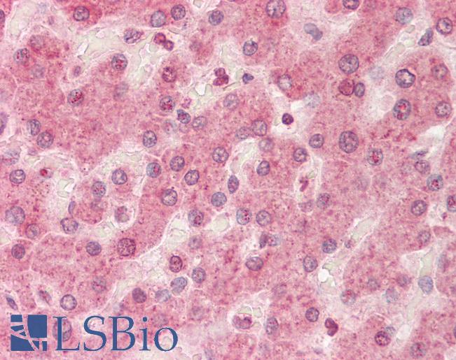 LDLR / LDL Receptor Antibody - Anti-LDLR / LDL Receptor antibody IHC staining of human liver. Immunohistochemistry of formalin-fixed, paraffin-embedded tissue after heat-induced antigen retrieval. Antibody concentration 5 ug/ml.  This image was taken for the unconjugated form of this product. Other forms have not been tested.