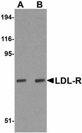 LDLR / LDL Receptor Antibody - Western blot of LDL-R in human liver tissue lysate with LDL-R antibody at (A) 1 and (B) 2 ug/ml. Below: Immunohistochemistry of LDL-R in human liver tissue with LDL-R antibody at 2.5 ug/ml.