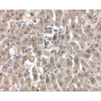 LDLR / LDL Receptor Antibody - Immunohistochemistry of LDL-R in human liver tissue with LDL-R antibody at 2.5 µg/mL.