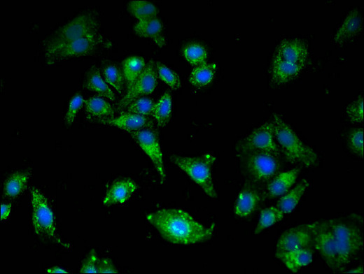 LDLR / LDL Receptor Antibody - Immunofluorescent analysis of HepG2 cells using LDLR Antibody at a dilution of 1:100 and Alexa Fluor 488-congugated AffiniPure Goat Anti-Rabbit IgG(H+L)