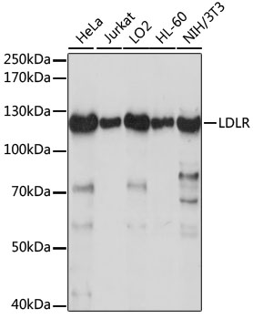 LDLR / LDL Receptor Antibody - Western blot analysis of extracts of various cell lines, using LDLR antibody at 1:1000 dilution. The secondary antibody used was an HRP Goat Anti-Rabbit IgG (H+L) at 1:10000 dilution. Lysates were loaded 25ug per lane and 3% nonfat dry milk in TBST was used for blocking. An ECL Kit was used for detection and the exposure time was 30s.