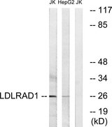LDLRAD1 Antibody - Western blot analysis of lysates from Jurkat and HepG2 cells, using LDLRAD1 Antibody. The lane on the right is blocked with the synthesized peptide.