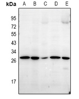 LDLRAD1 Antibody - Western blot analysis of LDLRAD1 expression in Jurkat (A), A549 (B), Panc1 (C), MEF (D), PC12 (E) whole cell lysates.