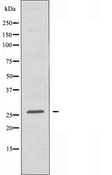 LDLRAD1 Antibody - Western blot analysis of extracts of Jurkat cells using LDLRAD1 antibody.