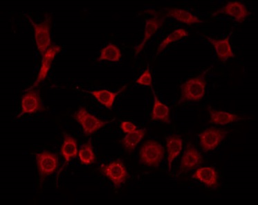 LDLRAD1 Antibody - Staining HeLa cells by IF/ICC. The samples were fixed with PFA and permeabilized in 0.1% Triton X-100, then blocked in 10% serum for 45 min at 25°C. The primary antibody was diluted at 1:200 and incubated with the sample for 1 hour at 37°C. An Alexa Fluor 594 conjugated goat anti-rabbit IgG (H+L) Ab, diluted at 1/600, was used as the secondary antibody.