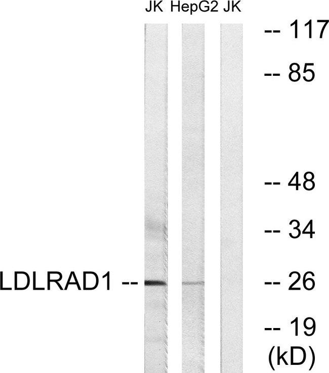 LDLRAD1 Antibody - Western blot analysis of extracts from Jurkat cells and HepG2 cells, using LDLRAD1 antibody.