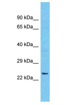 LDLRAD2 Antibody - LDLRAD2 antibody Western Blot of THP-1. Antibody dilution: 1 ug/ml.  This image was taken for the unconjugated form of this product. Other forms have not been tested.