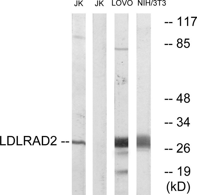 LDLRAD2 Antibody - Western blot analysis of lysates from Jurkat, LOVO, and NIH/3T3 cells, using LDLRAD2 Antibody. The lane on the right is blocked with the synthesized peptide.