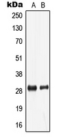 LDLRAD2 Antibody - Western blot analysis of LDLRAD2 expression in HeLa (A); human liver (B) whole cell lysates.