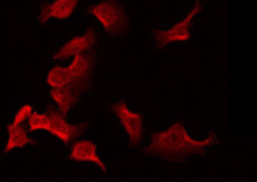LDLRAD2 Antibody - Staining HeLa cells by IF/ICC. The samples were fixed with PFA and permeabilized in 0.1% Triton X-100, then blocked in 10% serum for 45 min at 25°C. The primary antibody was diluted at 1:200 and incubated with the sample for 1 hour at 37°C. An Alexa Fluor 594 conjugated goat anti-rabbit IgG (H+L) Ab, diluted at 1/600, was used as the secondary antibody.
