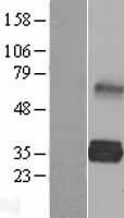 LDLRAD2 Protein - Western validation with an anti-DDK antibody * L: Control HEK293 lysate R: Over-expression lysate