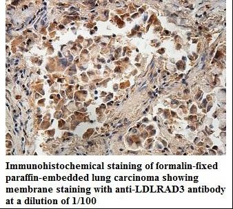 LDLRAD3 Antibody
