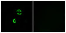 LDLRAD3 Antibody - Immunofluorescence analysis of A549 cells, using LDLRAD3 Antibody. The picture on the right is blocked with the synthesized peptide.