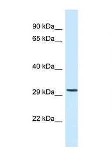 LDLRAD4 / C18orf1 Antibody - C18orf1 antibody Western blot of Fetal Heart lysate. Antibody concentration 1 ug/ml.  This image was taken for the unconjugated form of this product. Other forms have not been tested.