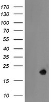 LDOC1 Antibody - HEK293T cells were transfected with the pCMV6-ENTRY control (Left lane) or pCMV6-ENTRY LDOC1 (Right lane) cDNA for 48 hrs and lysed. Equivalent amounts of cell lysates (5 ug per lane) were separated by SDS-PAGE and immunoblotted with anti-LDOC1.