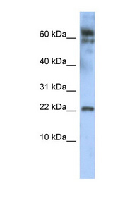 LDOC1 Antibody - LDOC1 antibody Western blot of HepG2 cell lysate. This image was taken for the unconjugated form of this product. Other forms have not been tested.