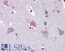 LDOC1 Antibody - Anti-LDOC1 antibody IHC of human brain, cortex. Immunohistochemistry of formalin-fixed, paraffin-embedded tissue after heat-induced antigen retrieval. Antibody concentration 5 ug/ml.  This image was taken for the unconjugated form of this product. Other forms have not been tested.
