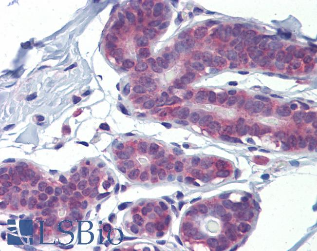 LDOC1 Antibody - Anti-LDOC1 antibody IHC of human breast. Immunohistochemistry of formalin-fixed, paraffin-embedded tissue after heat-induced antigen retrieval. Antibody concentration 5 ug/ml.  This image was taken for the unconjugated form of this product. Other forms have not been tested.