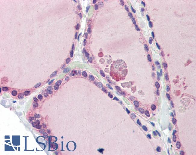 LDOC1 Antibody - Anti-LDOC1 antibody IHC of human thyroid. Immunohistochemistry of formalin-fixed, paraffin-embedded tissue after heat-induced antigen retrieval. Antibody concentration 5 ug/ml.  This image was taken for the unconjugated form of this product. Other forms have not been tested.