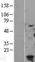 LDOC1 Protein - Western validation with an anti-DDK antibody * L: Control HEK293 lysate R: Over-expression lysate