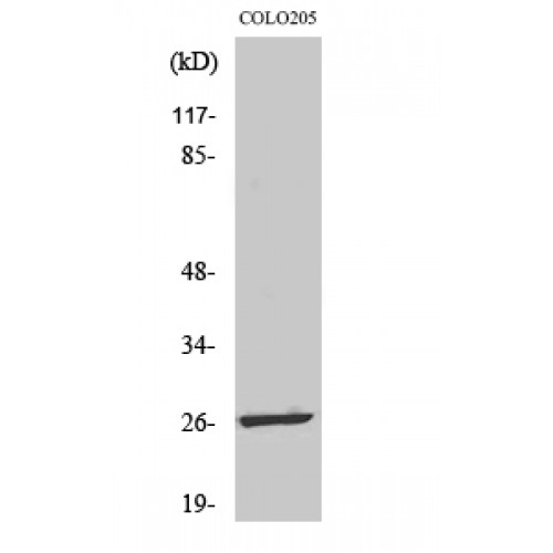 LDOC1L Antibody - Western blot of LDOC1L antibody