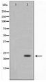 LDOC1L Antibody - Western blot of COLO205 cell lysate using LDOC1L Antibody