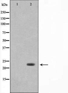 LDOC1L Antibody - Western blot analysis on COLO205 cell lysates using LDOC1L antibody. The lane on the left is treated with the antigen-specific peptide.