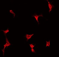 LDOC1L Antibody - Staining COLO205 cells by IF/ICC. The samples were fixed with PFA and permeabilized in 0.1% Triton X-100, then blocked in 10% serum for 45 min at 25°C. The primary antibody was diluted at 1:200 and incubated with the sample for 1 hour at 37°C. An Alexa Fluor 594 conjugated goat anti-rabbit IgG (H+L) Ab, diluted at 1/600, was used as the secondary antibody.