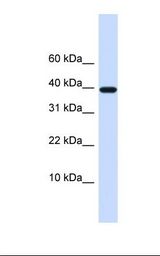 LECT1 / Chondromodulin-I Antibody - 721_B cell lysate. Antibody concentration: 1.0 ug/ml. Gel concentration: 10-20%.  This image was taken for the unconjugated form of this product. Other forms have not been tested.