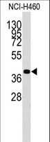 LECT1 / Chondromodulin-I Antibody - Western blot of anti-LECT1 Antibody in NCI-H460 cell line lysates (35 ug/lane). LECT1(arrow) was detected using the purified antibody.