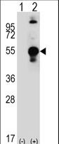 LECT1 / Chondromodulin-I Antibody - Western blot of LECT1 (arrow) using rabbit polyclonal LECT1 Antibody. 293 cell lysates (2 ug/lane) either nontransfected (Lane 1) or transiently transfected (Lane 2) with the LECT1 gene.