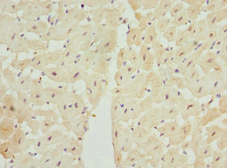 LECT1 / Chondromodulin-I Antibody - Immunohistochemistry of paraffin-embedded human heart tissue at dilution 1:100