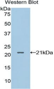 LECT2 Antibody - Western blot of recombinant LECT2.  This image was taken for the unconjugated form of this product. Other forms have not been tested.